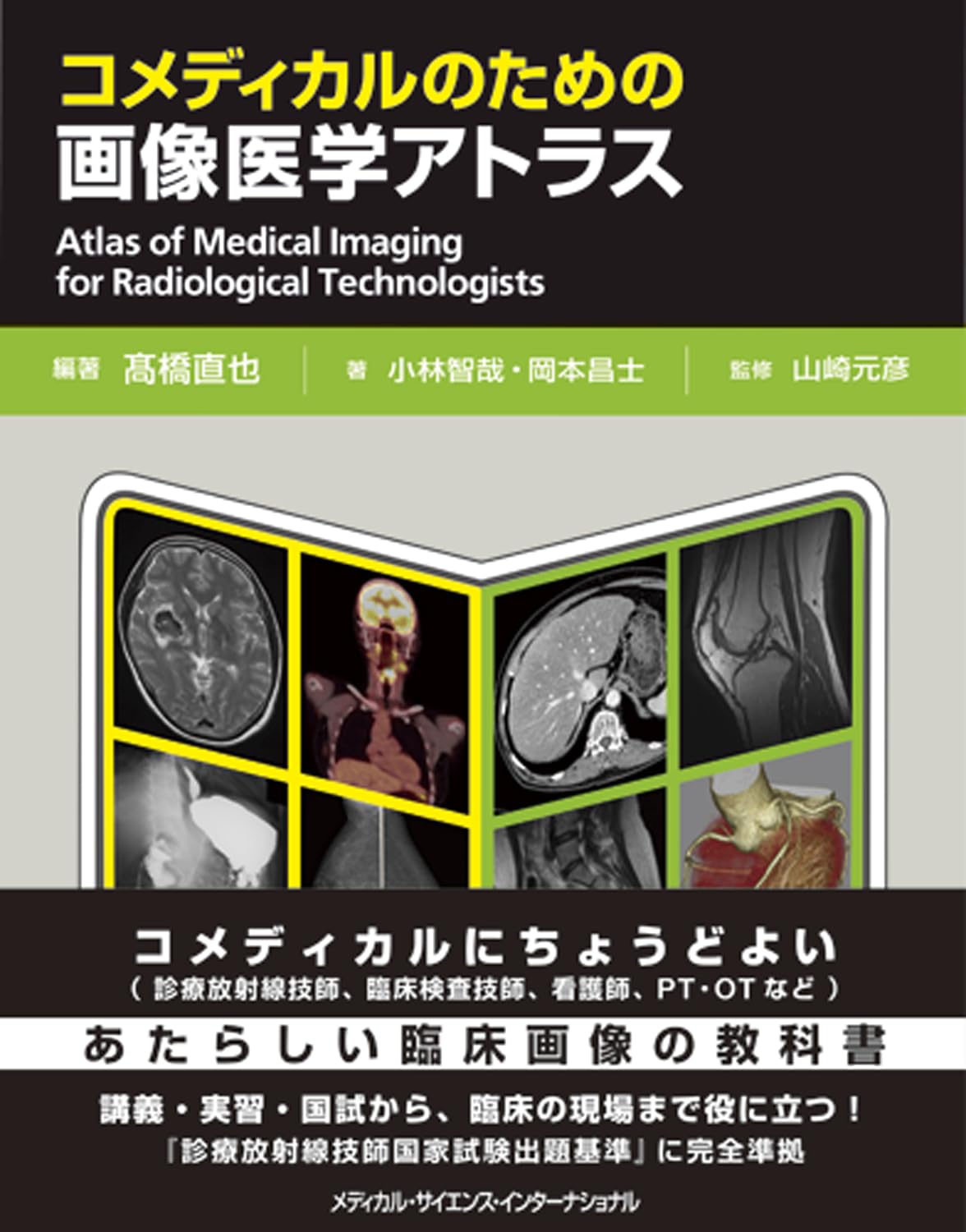 コメディカルのための画像医学アトラス | 髙橋直也 |本 | 通販 | Amazon